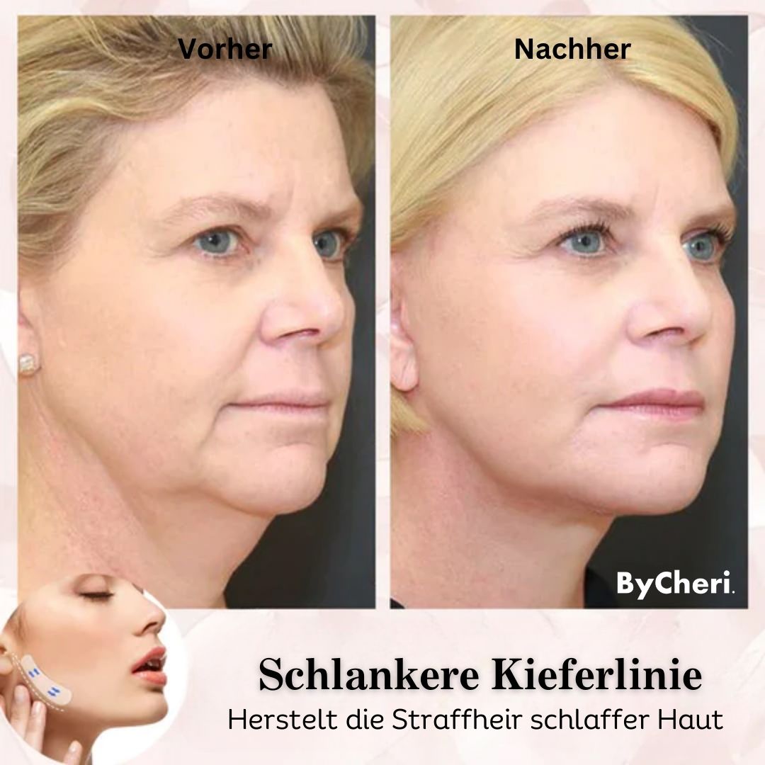 1 + 1 GRATIS HEUTE | 2025 Unsichtbares Facelifting-Band-Set™