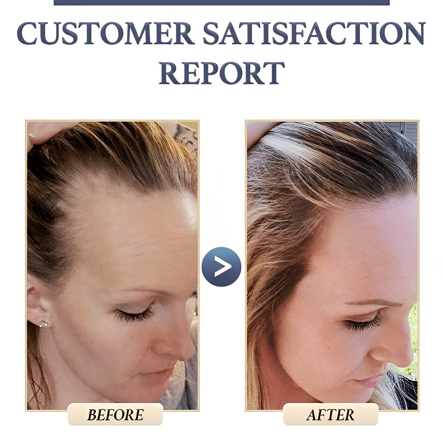 1 + 1 GRATIS HEUTE | SorcerySoap™ -Anti-Haarausfall-Reis Shampoobar