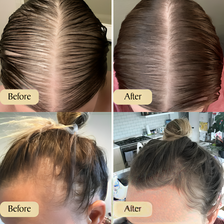 1 + 1 GRATIS HEUTE | VitaLocks™ | Genieße schönes & gesundes Haar!