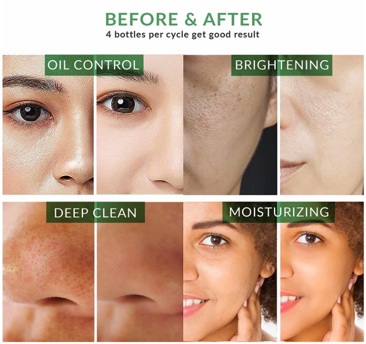 1+1 GRATIS | CleanSkin™ – Strahlende Haut in 15 Minuten ohne Reizungen!