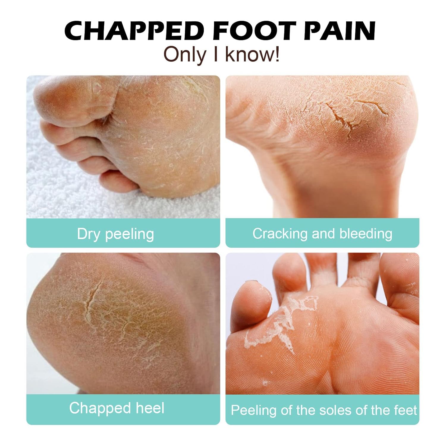 1+1 GRATIS | Medical Foot Care Cream™ — Heilt und schützt rissige Haut für langanhaltenden Komfort