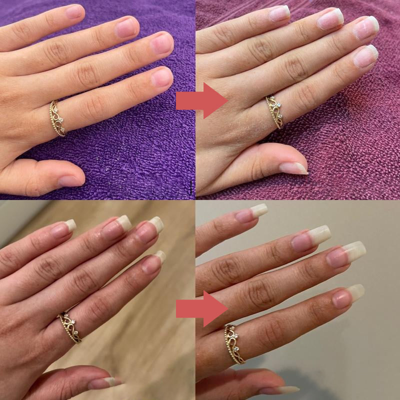 1+1 GRATIS | Nails Nutritious Growth Oil™ – Entfalte stärkere, gesündere Nägel, die bei jeder Berührung glänzen