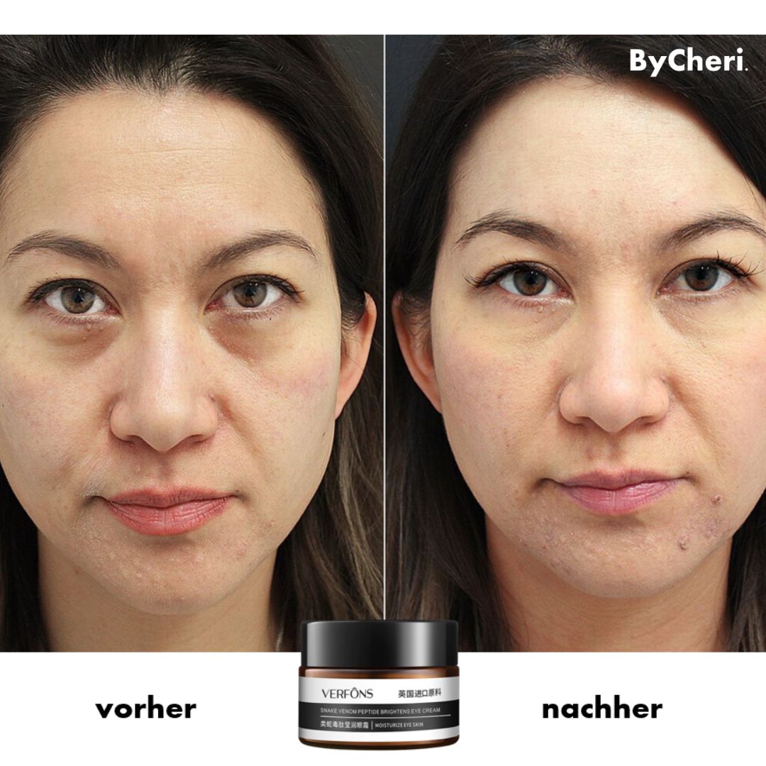 1+1 GRATIS TEMPORÄR | EyeRejuv™- Faltenentfernende Augencreme!