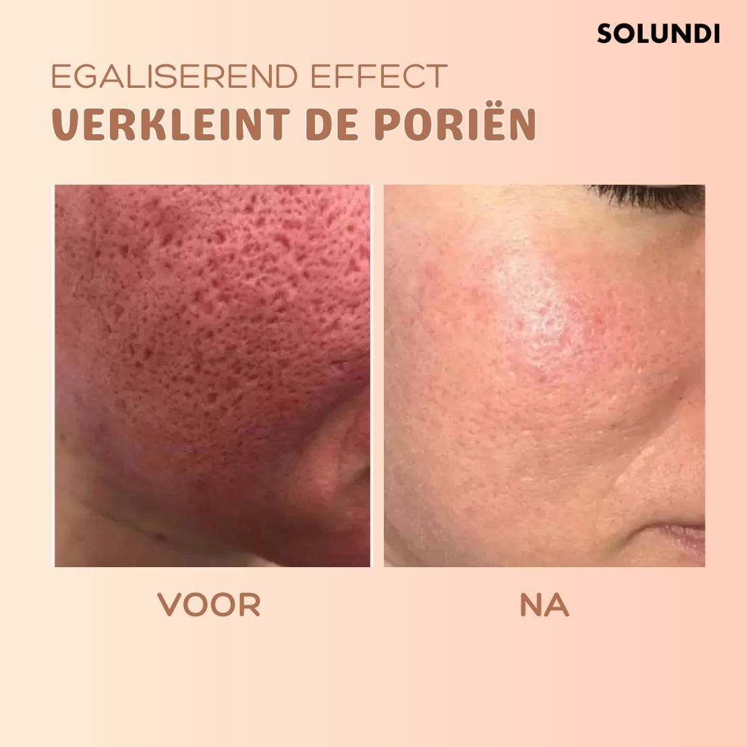 Anti-Falten-Hauterneuerungsbalsam für Damen | 7 g mit Karottensamenöl & Avocado | Mindert feine Linien & spendet Feuchtigkeit 5
