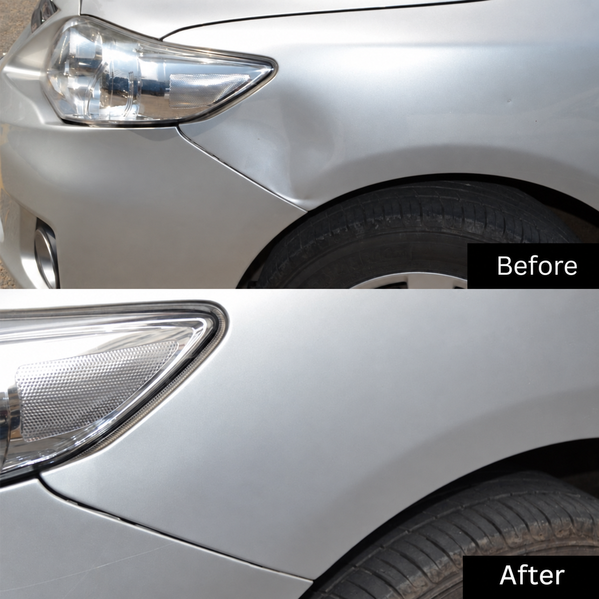 Nástroj na opravu preliačin | Zdvíhač preliačin | s ťažným mostíkom a lepiacimi adaptérmi | DentLift