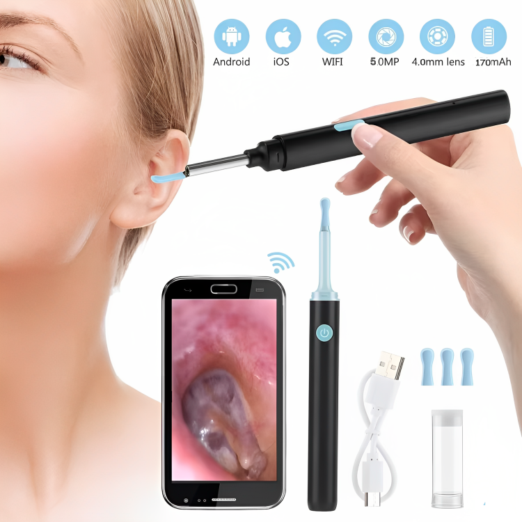 EarClear™ | Mühelose Entfernung von Ohrenschmalz mit Echtzeit-Visualisierung!