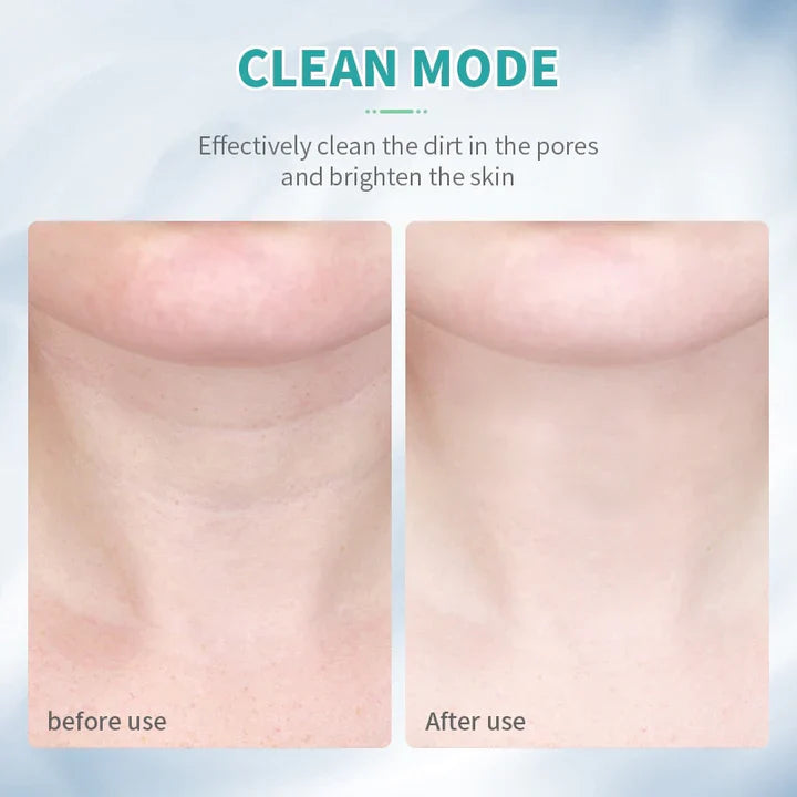 FaceGlow™- Erreichen Sie Ihr perfektes Gesicht!