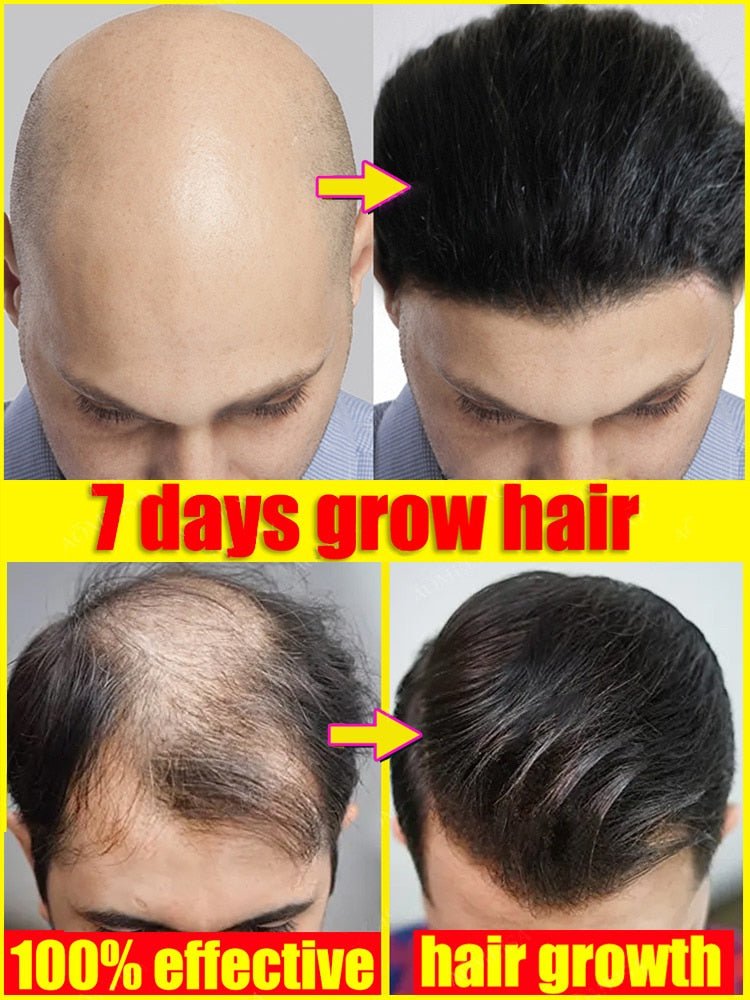 Haaröl Kopfhaut | Nährt Kopfhaut und Haarwurzeln | Unterstützt dichteres Haargefühl | Follicare