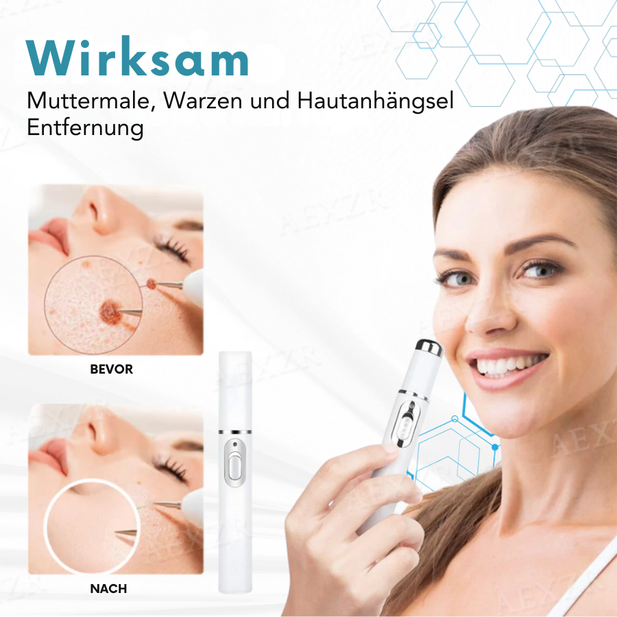 Hautverjüngung Stift | Präzise Hautkorrektur | Nicht-invasive Plasma Technologie | Bikenda