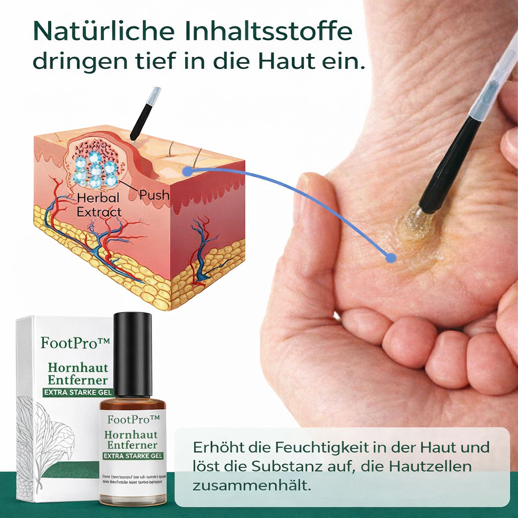 Hornhautentferner | Punktgenauer Applikator | Extra starke Wirkung | FootPro