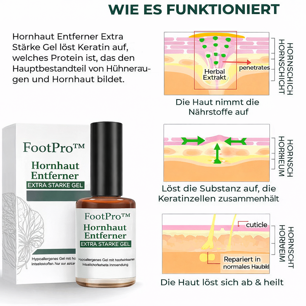 Hornhautentferner | Punktgenauer Applikator | Extra starke Wirkung | FootPro