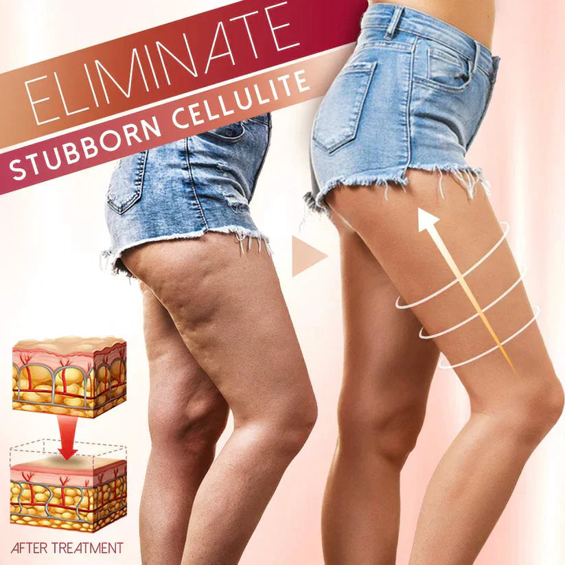 Massage für straffere Silhouette | Vibrationsgerät 60.000/min | Cellulite | Vibroscu