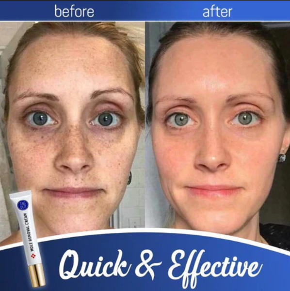 Miracle Cream™ - Erhalten Sie eine strahlende Haut