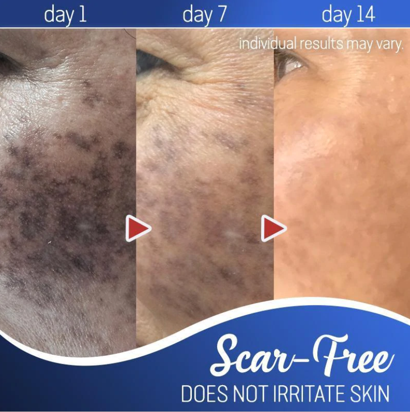 Miracle Cream™ - Erhalten Sie eine strahlende Haut