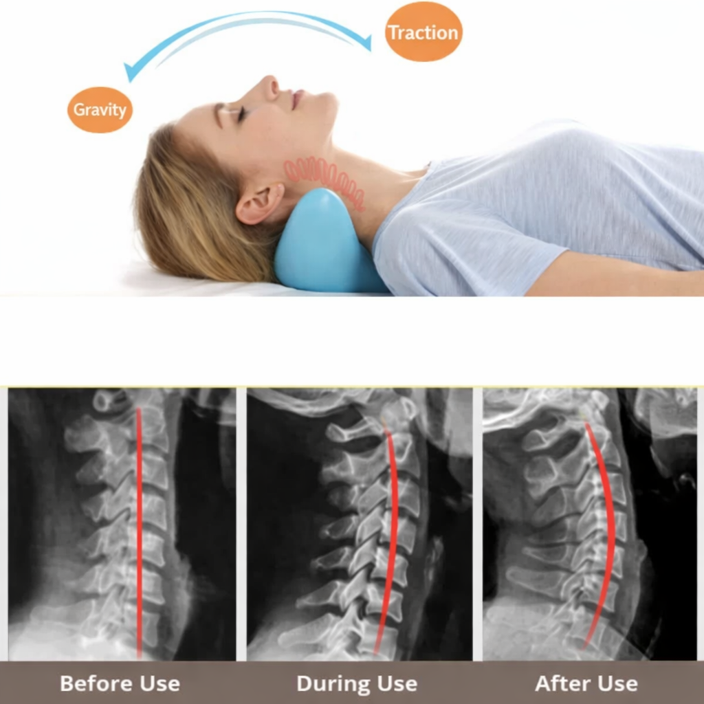 Nackenmassagekissen | Nacken Stretch | Sofort Entlastung | RelaxoFlex