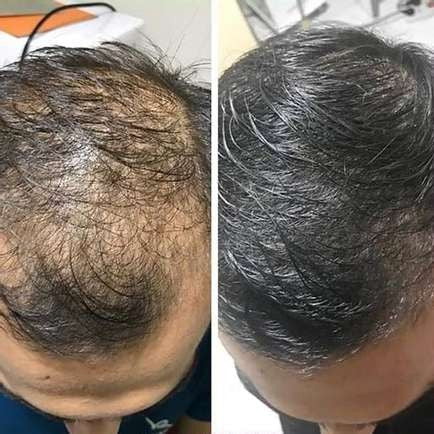 Natürliches Haarwachstum Shampoo | Weniger Haarausfall | Sanfte Kopfhautpflege | RiceBloom
