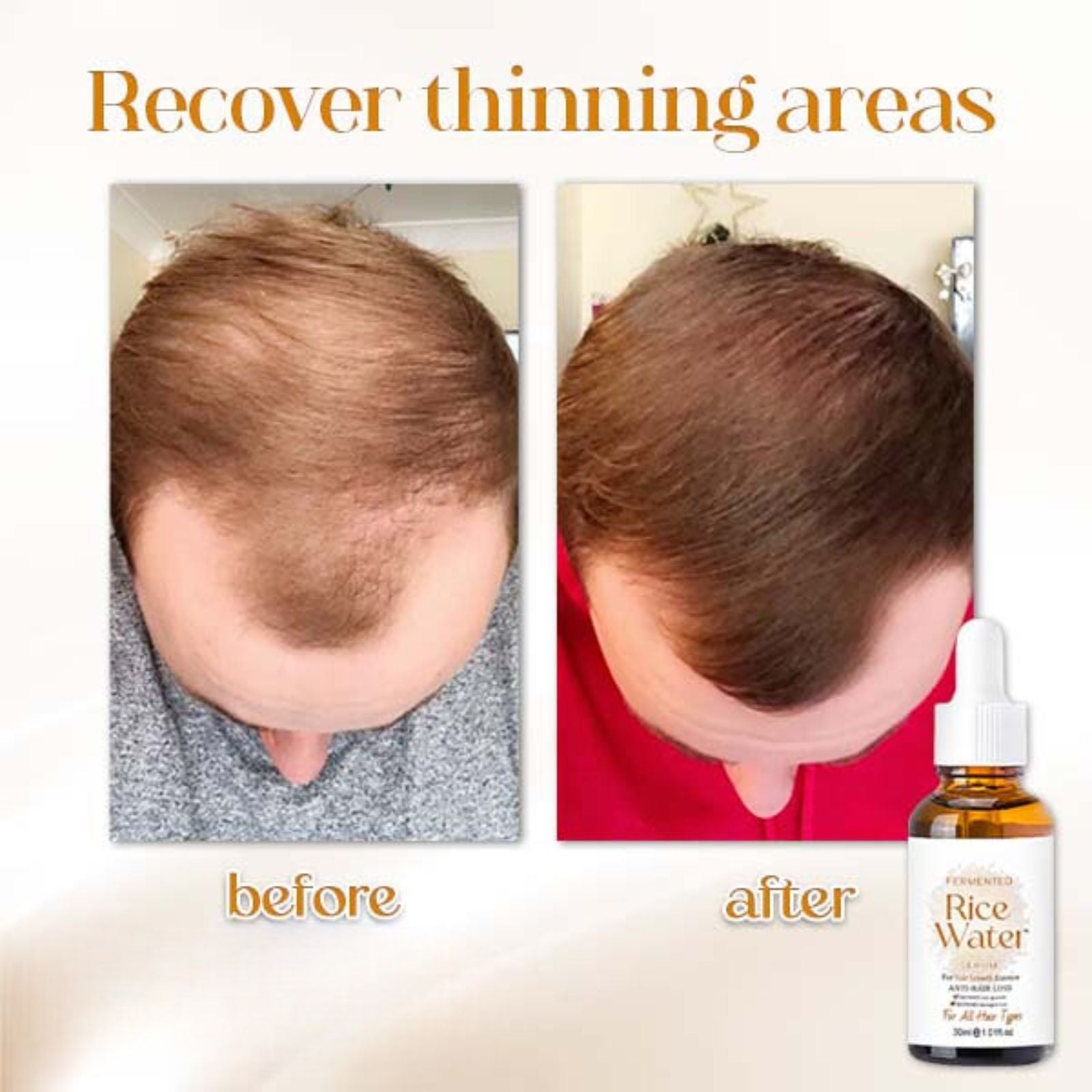 PoreAid™ | Japanisches fermentiertes Reiswasser Haarserum