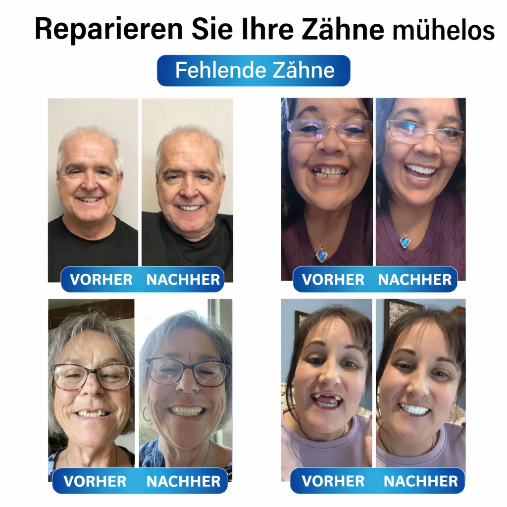 Prothesen | Zahnreparatur Set mit LED | Formbares Denture Gel | Futusly