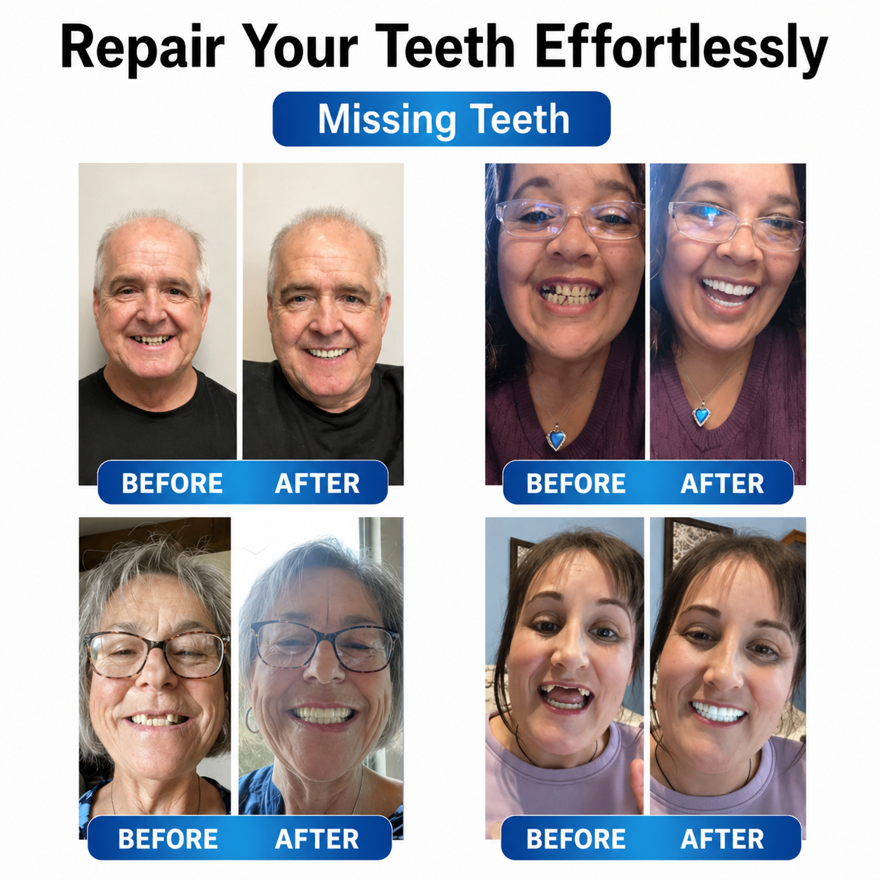 Prothesen | Zahnreparatur Set mit LED | Formbares Denture Gel | Futusly