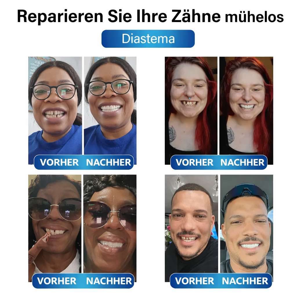 Prothesen | Zahnreparatur Set mit LED | Formbares Denture Gel | Futusly