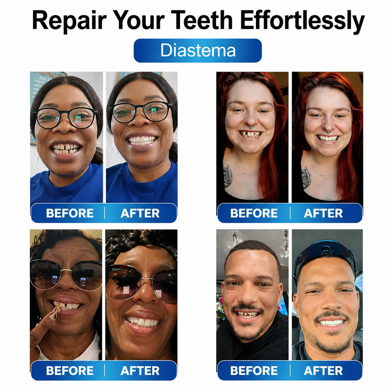 Prothesen | Zahnreparatur Set mit LED | Formbares Denture Gel | Futusly