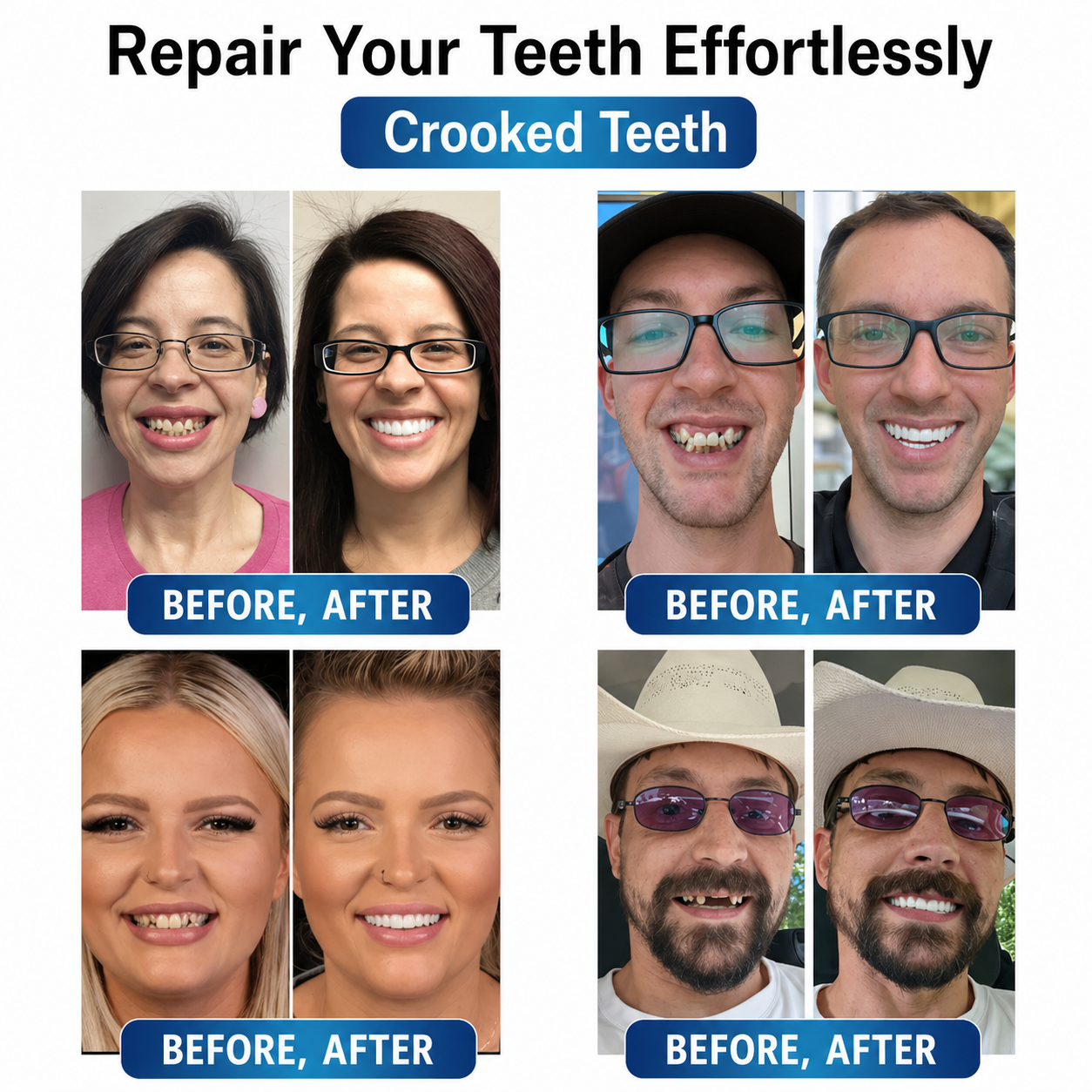 Prothesen | Zahnreparatur Set mit LED | Formbares Denture Gel | Futusly