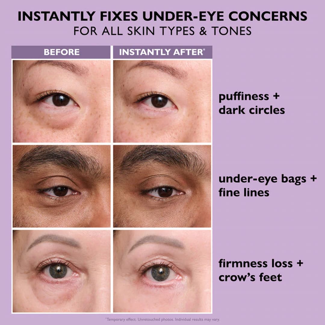 Revitalisierender Augenstraffer | Sofort Lifting Effekt | Glättet Augenpartie | EyeRevive