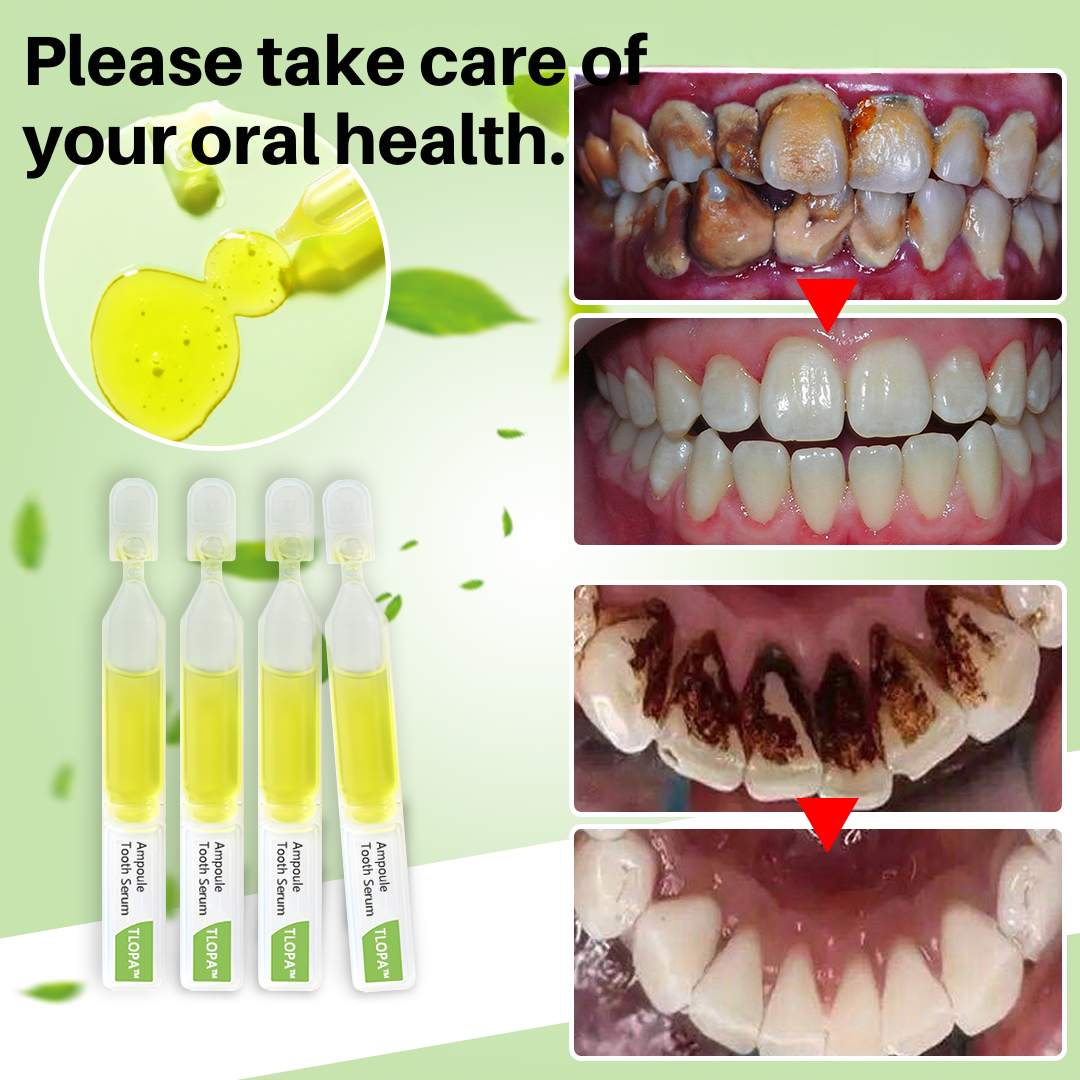 Zahnaufhellung | Zahnstein Entfernung | Natürliche Inhaltsstoffe | CalciClear