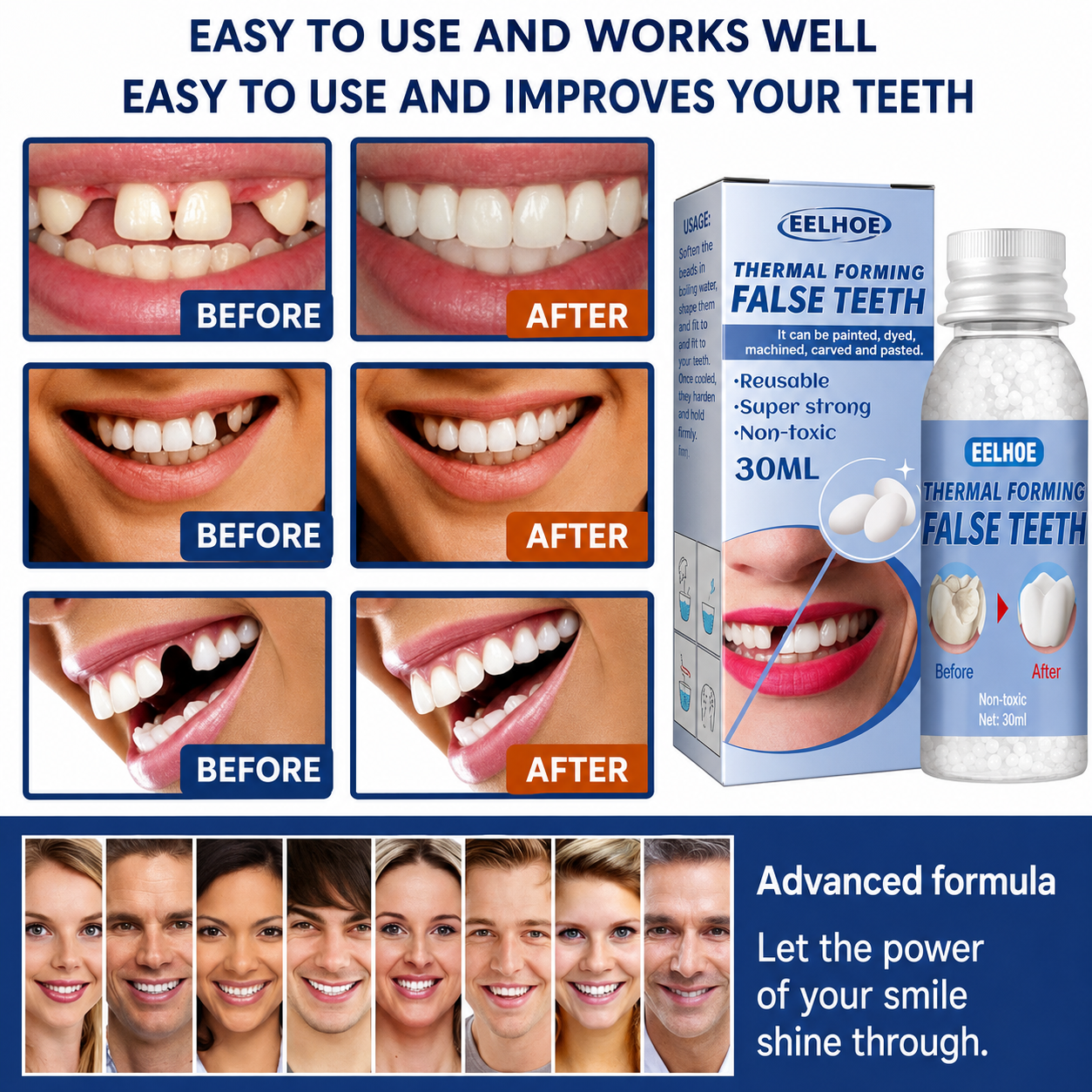Zahnpflege | Zahnreparatur-Set | Sofortige Füllung von Zahnlücken | ToothPerfect