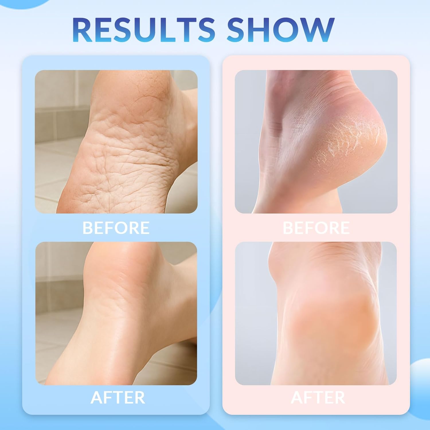 1 + 1 GRATIS HEUTE | NourishBalm™