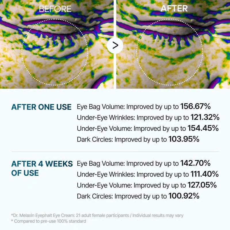 1+1 GRATIS | FirmEye™ Erfrischt müde Augen, enthüllt jugendlichen Glanz