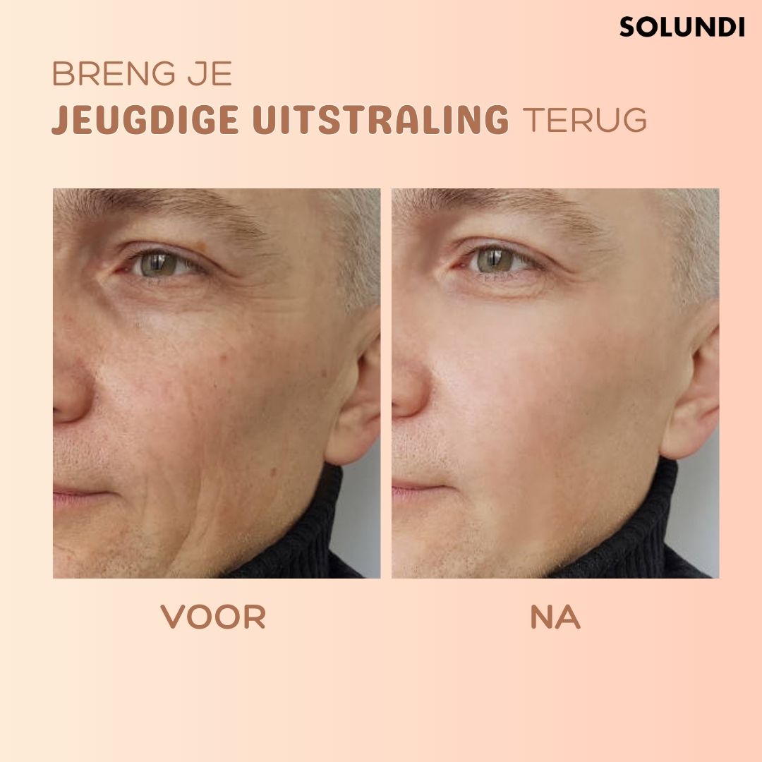 Anti-Falten-Hauterneuerungsbalsam für Damen | 7 g mit Karottensamenöl & Avocado | Mindert feine Linien & spendet Feuchtigkeit 6