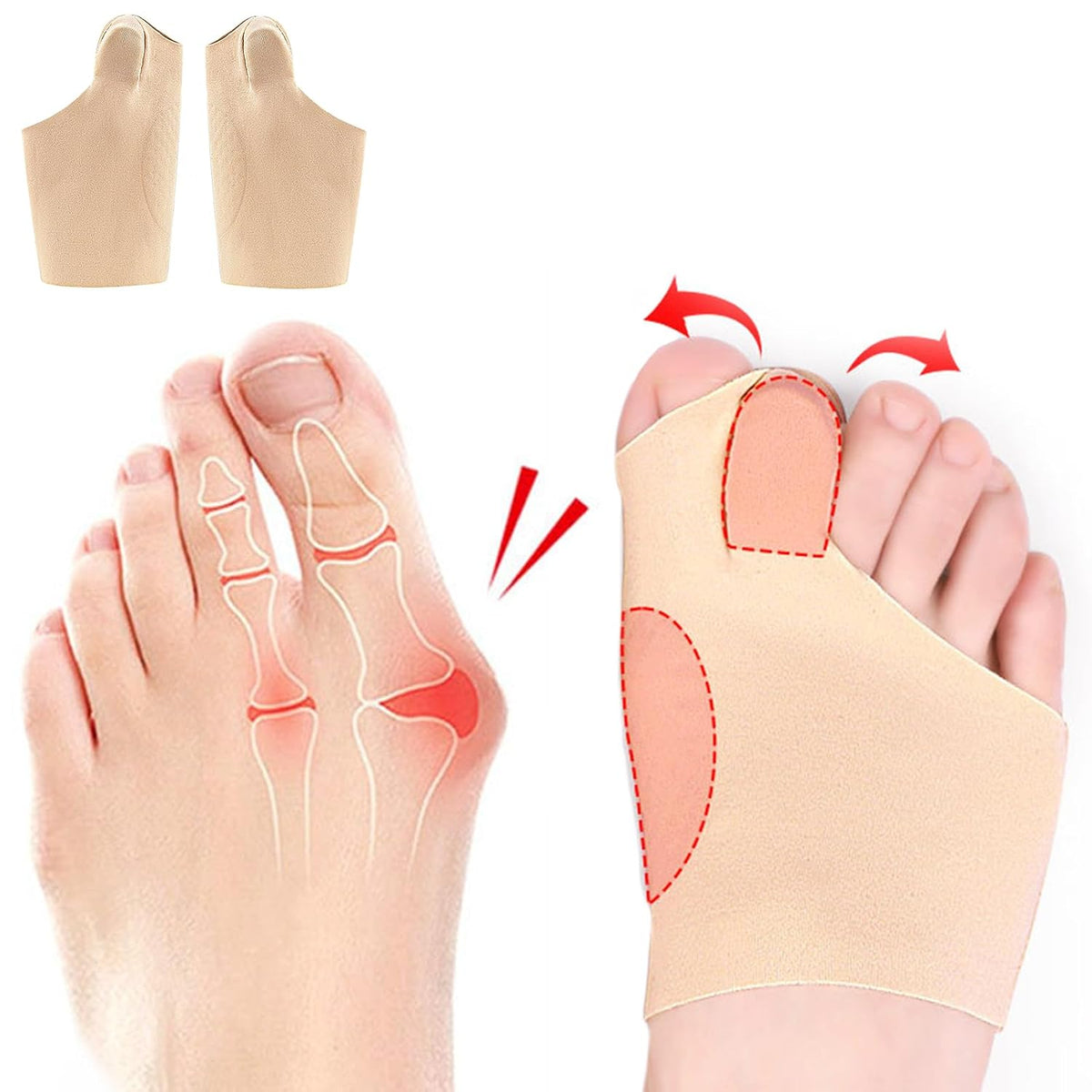 Correcteur d’orteil pour le gros orteil | Réalignement en douceur sans opération | Invisible sous toutes les chaussures, même à talons