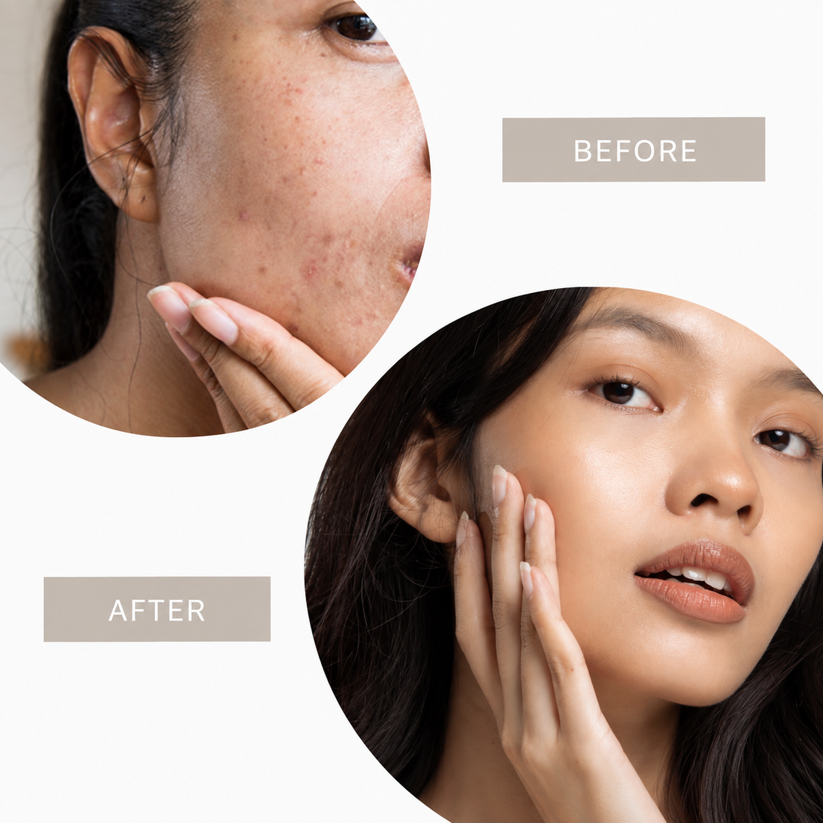 Crème CC pour tous les types de peau | Acide hyaluronique, vitamine E & SPF 20 | Couvre les rides, l’acné et les rougeurs, résistante à l’eau