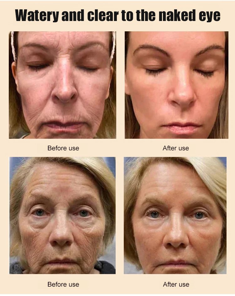 Contour Gesichtsbürste | Lymph Massage Pinsel | Weiche Borsten sanftes Gefühl | Lynure