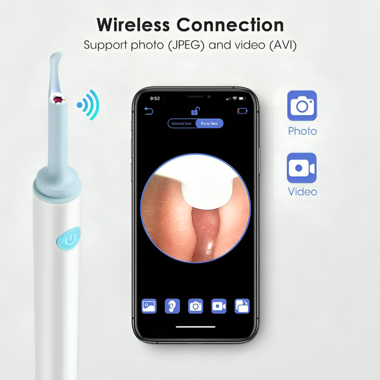 EarClear™ | Mühelose Entfernung von Ohrenschmalz mit Echtzeit-Visualisierung!