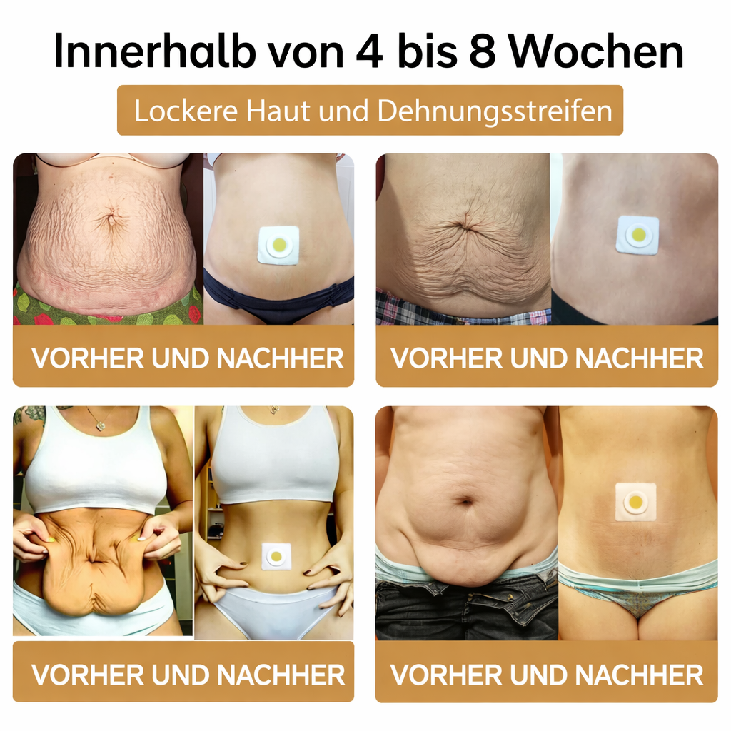 Fettverbrenner | Bienengift Kräuterextrakte | Transdermale Figurpflege | BeeSlim Patch