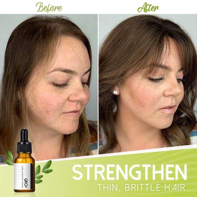 GRO+ HAIR SERUM™ | VOLLERES HAAR ERHALTEN
