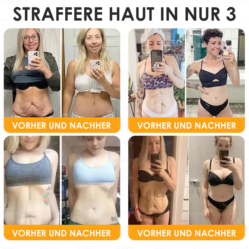 Haut Heilen Anti-Aging-Creme | Hautstraffung und -erneuerung | Bienenpeptid-Formel | HealSkin