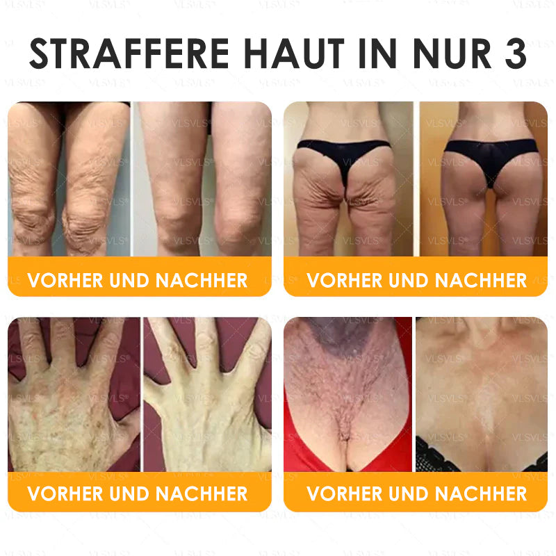 Haut Heilen Anti-Aging-Creme | Hautstraffung und -erneuerung | Bienenpeptid-Formel | HealSkin