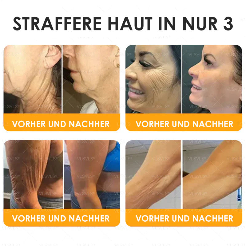 Haut Heilen Anti-Aging-Creme | Hautstraffung und -erneuerung | Bienenpeptid-Formel | HealSkin