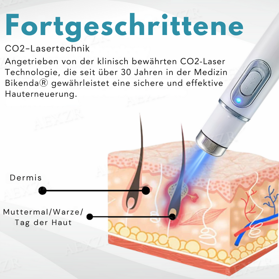 Hautverjüngung Stift | Präzise Hautkorrektur | Nicht-invasive Plasma Technologie | Bikenda