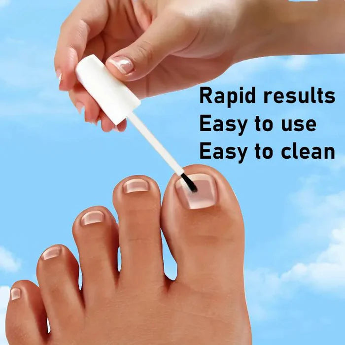 Nagelpflege | Stärkt brüchige Nägel | Spendet Nagelhaut Feuchtigkeit | VitaNails
