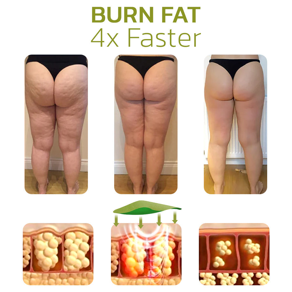 NaturLean™ - Pflaster zur Reduzierung von Cellulite