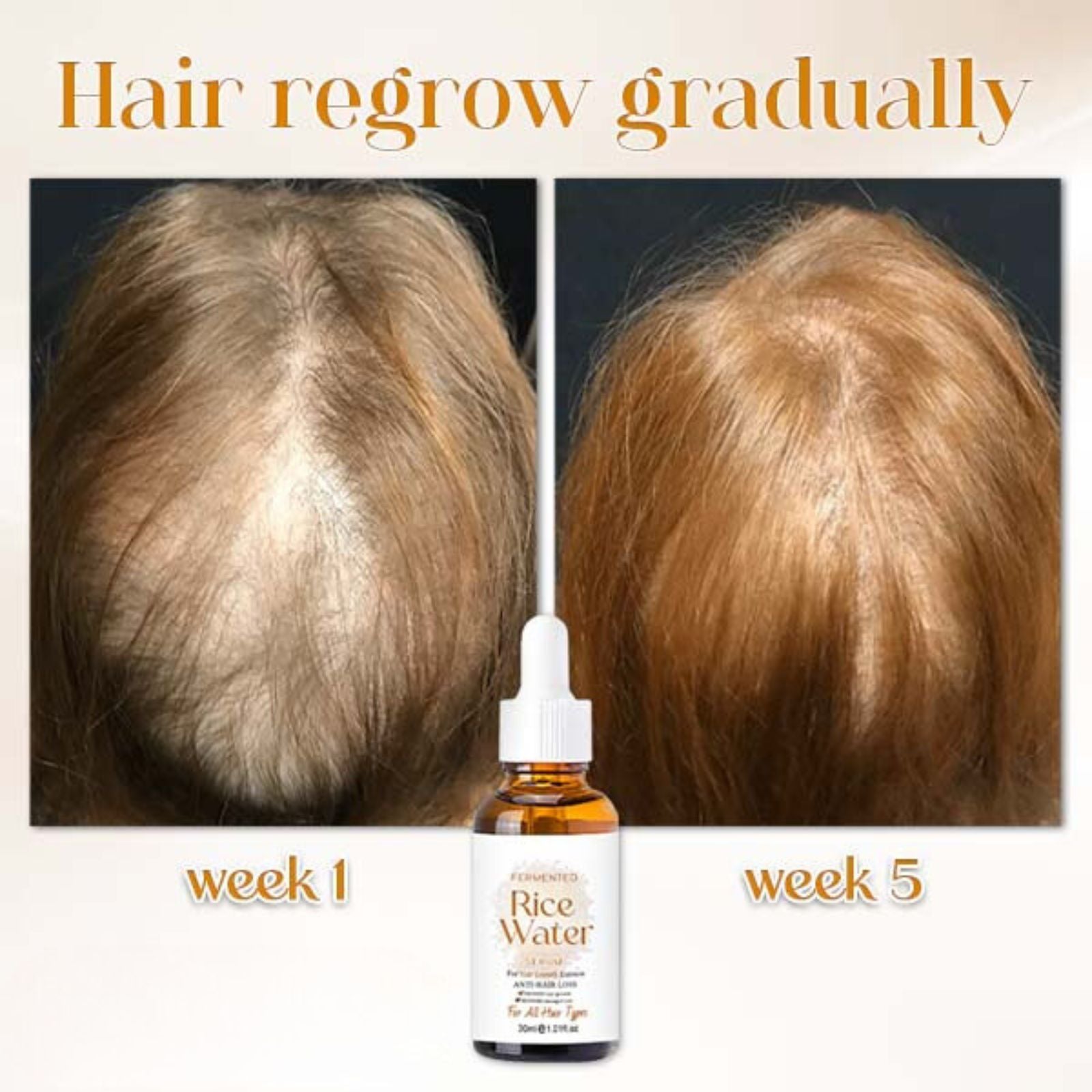 PoreAid™ | Japanisches fermentiertes Reiswasser Haarserum