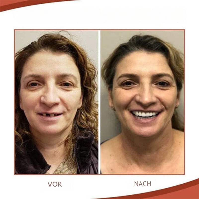 Prothesen | Zahnprothesen Anpassung | Sicherer Halt & Natürliches Lächeln | PureSmile