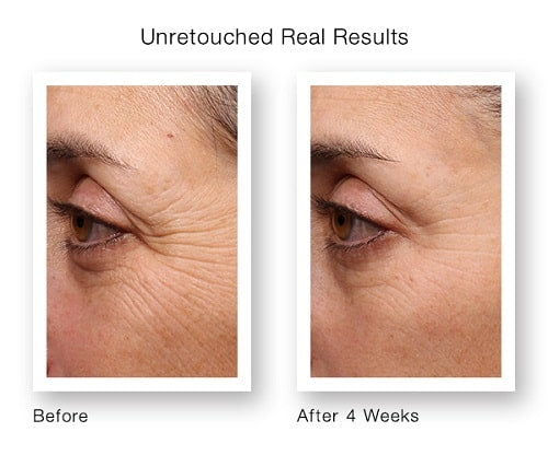 Retinol Anti-Aging-Serum