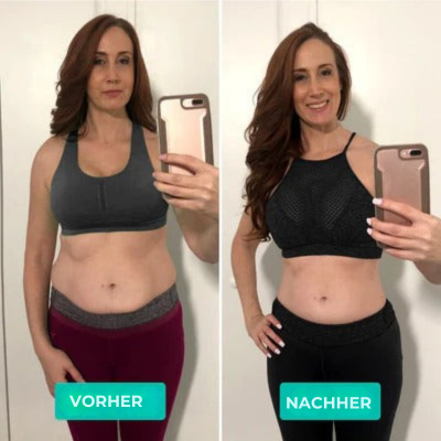 Schlankheits‑Massagegerät | Vibrationsmassage | Hautstraffung | Sculptiva