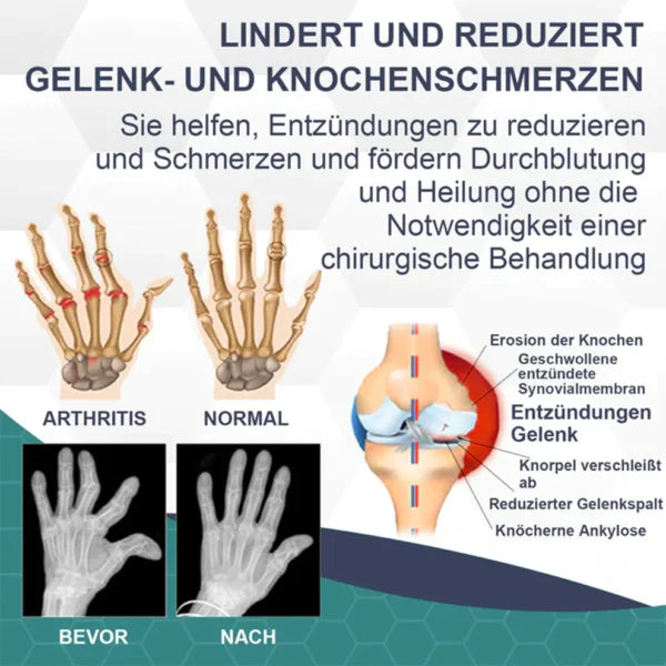 Schmerzmittel | Bienengift Pflege für Gelenke | Wärmende Tiefenwirkung Massage | BeeRelief