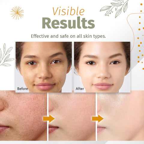 Spotless Skin Serum™- Organisches Serum zur Lösung von Hautflecken